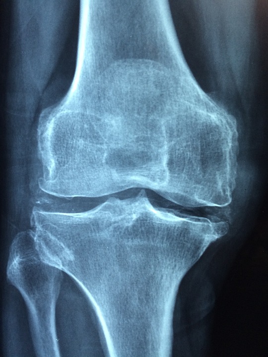 Was ist Rheuma? Eine umfassende Einführung und FAQ zu den Symptomen, Ursachen und Behandlungsmöglichkeiten